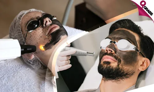 Flawless Skin with Carbon Laser Peel for Ladies & Men!